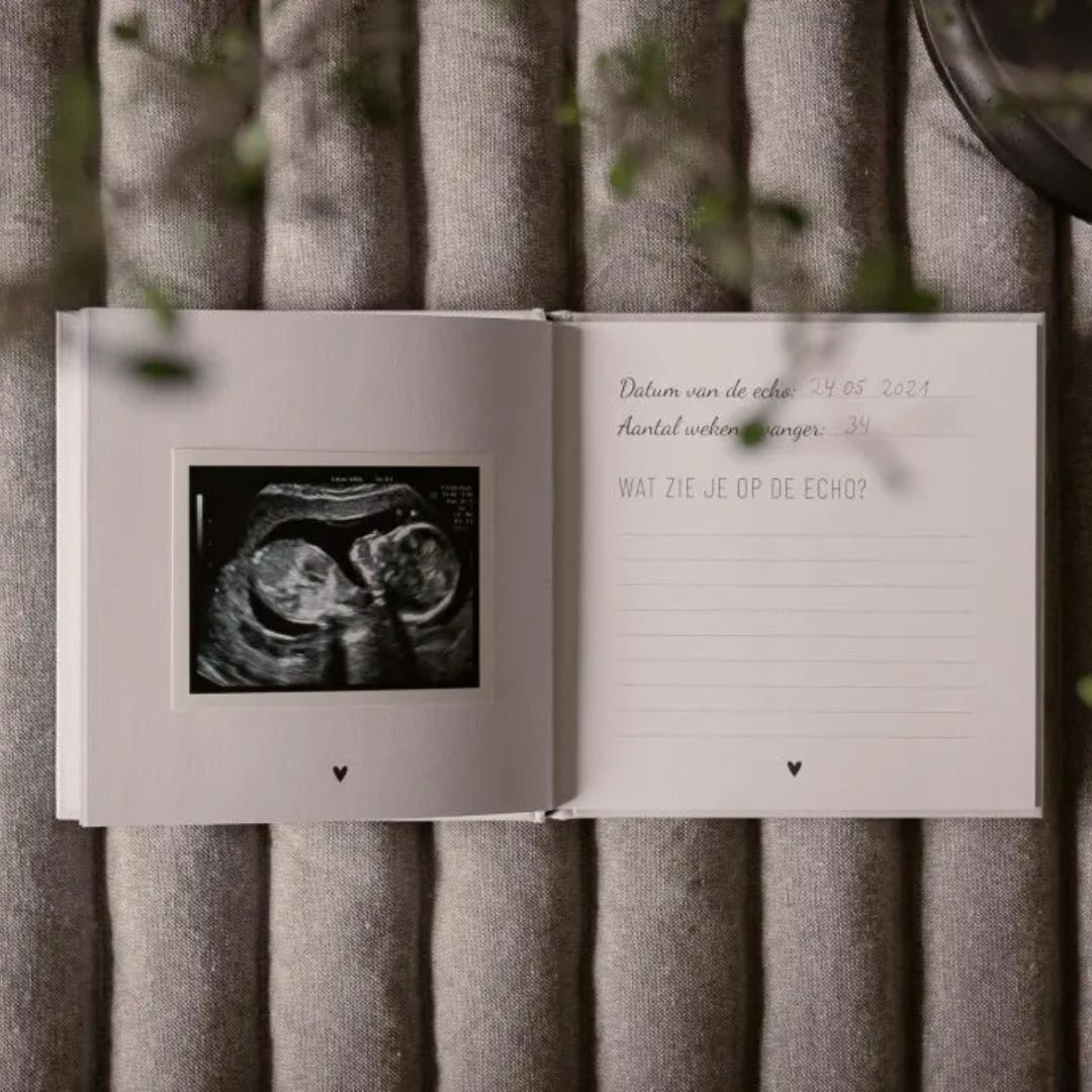 Echo | Fotoboek voor de echo’s